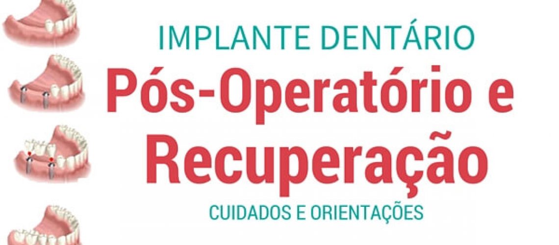 implante dentario cuidados pos operatorio e recuperação (1)