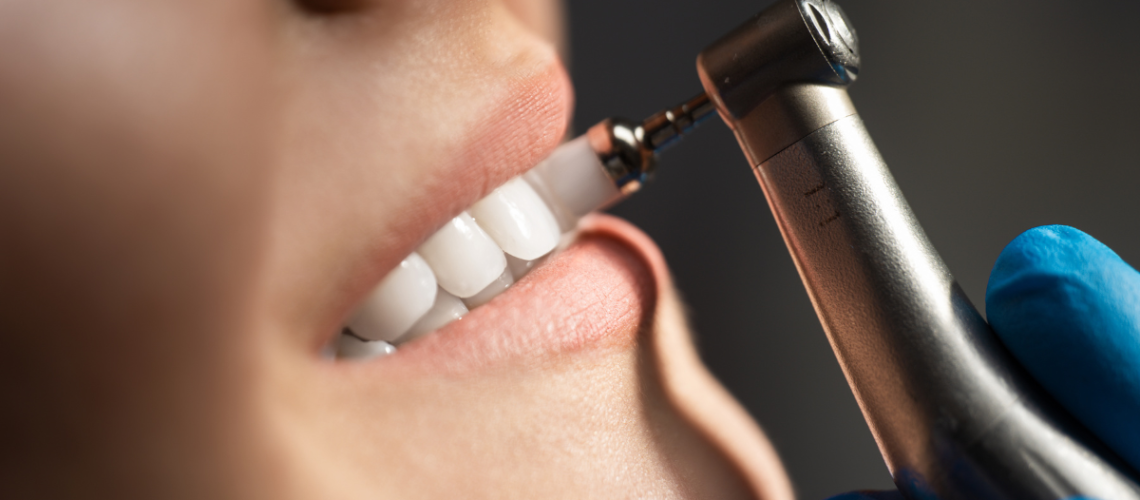 limpeza dental DR. ALEXANDREVOLTOLINI (1200 x 675 px)