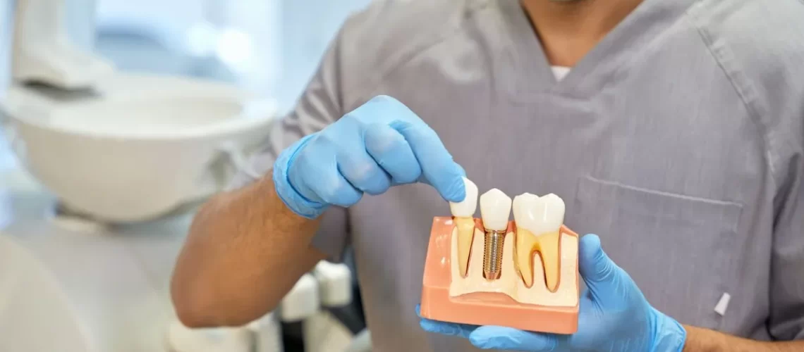 manutenção-dos-implantes-dentários_dralexandrevoltolini-