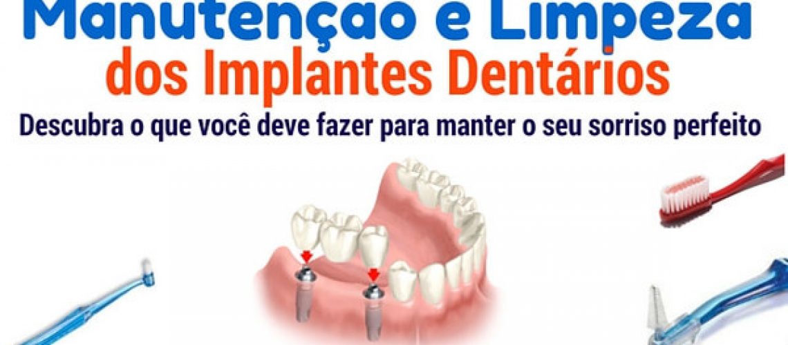 manutençao e higienização dos implantes dentarios 600