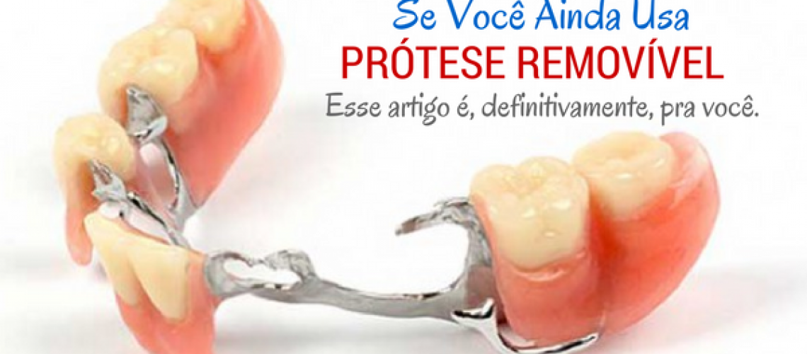 prótese dentária removível parcial ou total