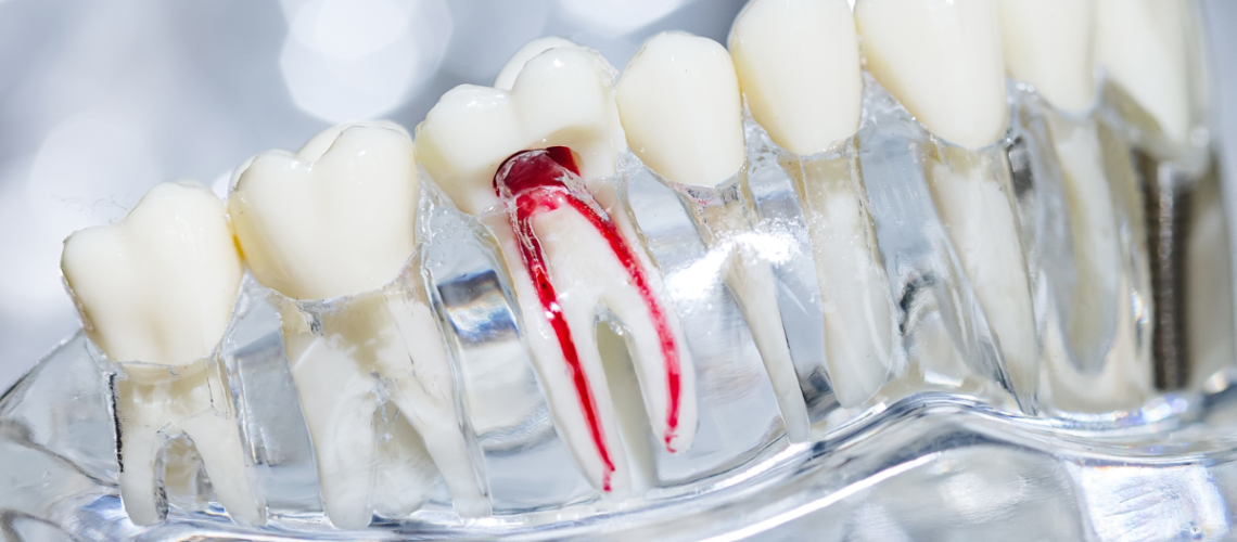 tratamento de canal em blumenau dr alexandr voltonini